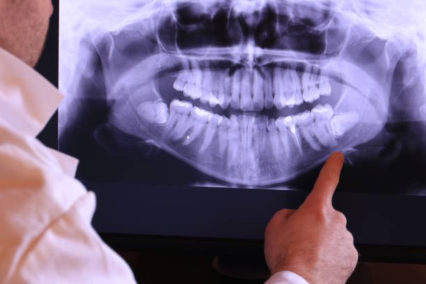 Best Emergency Care for Gum Disease in El Dorado Hills, CA